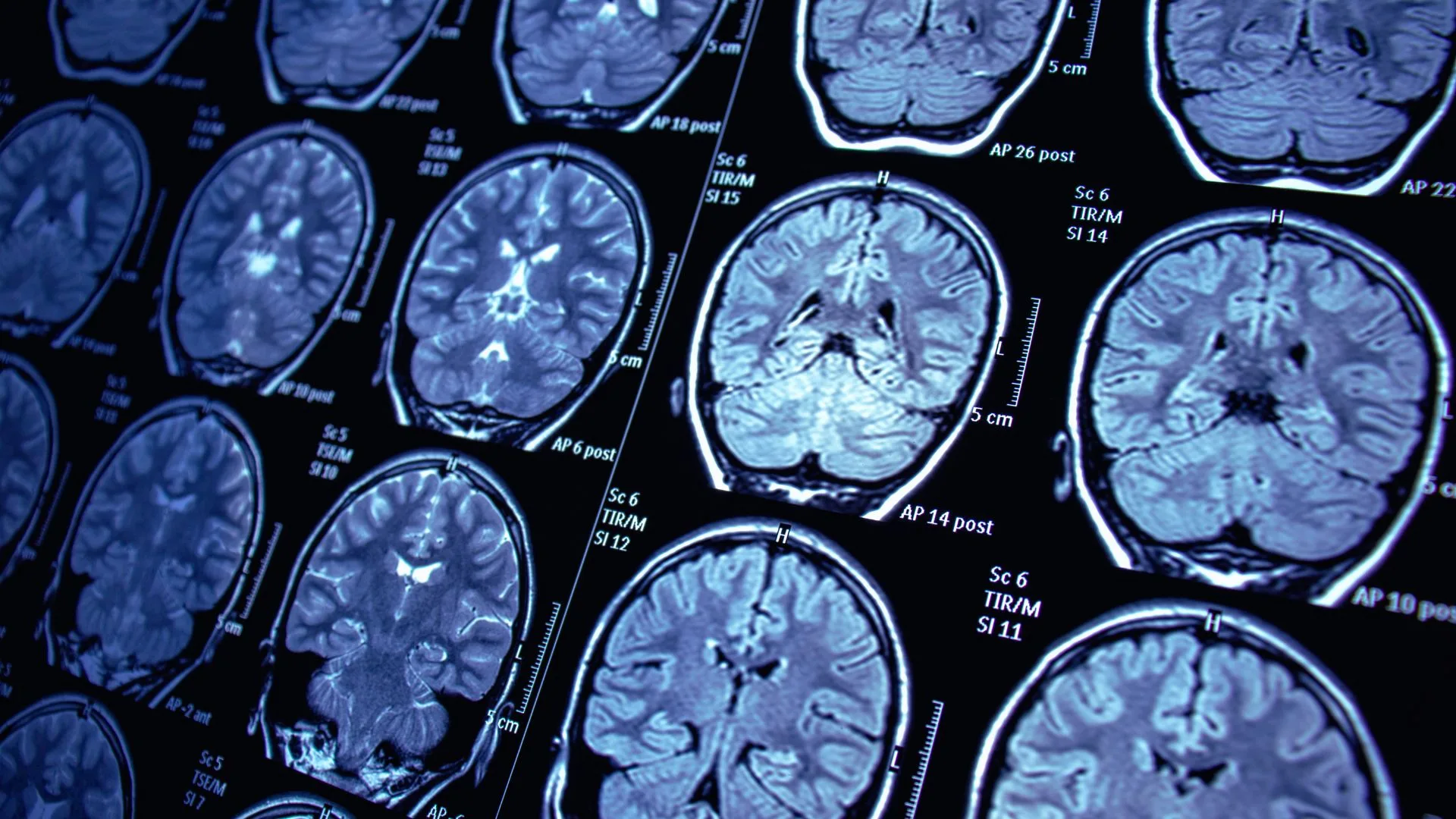 Validating the Future of Neuromodulation: How Jordi Labs Supports Regulatory-Ready Innovation